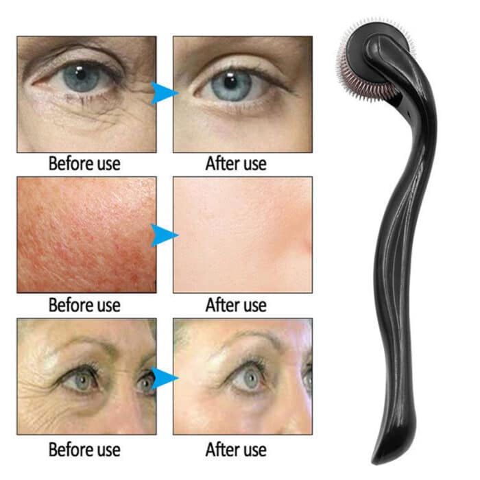 Derma Roller for Hair Growth Beard